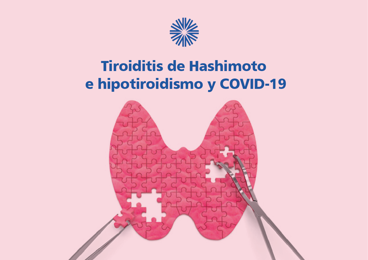 Tiroiditis de Hashimoto e hipotiroidismo y COVID-19