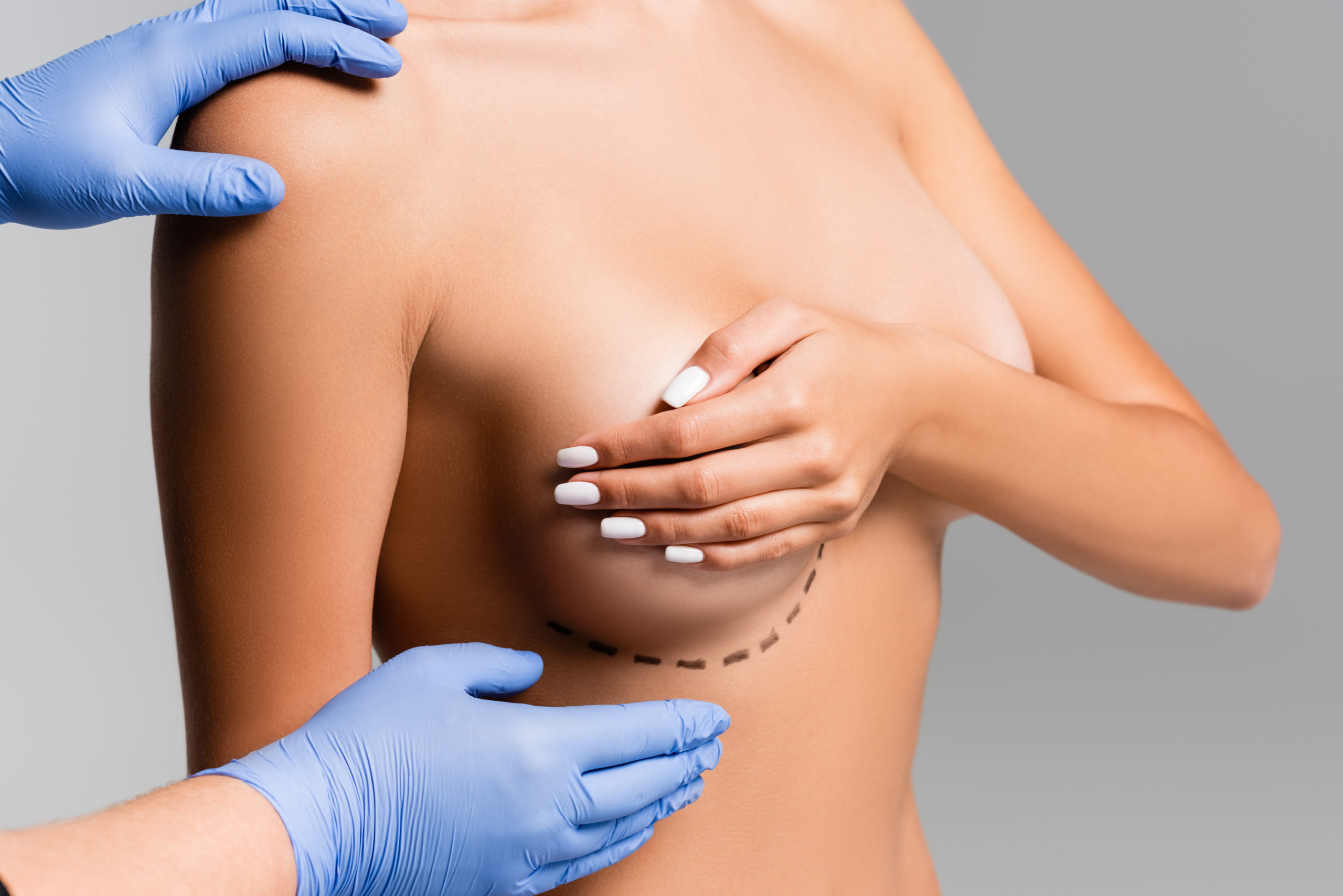 Tipos de cirugías mamarias